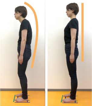 定額制プランの方には入会時点の姿勢を撮影して見ていただく事ができます。